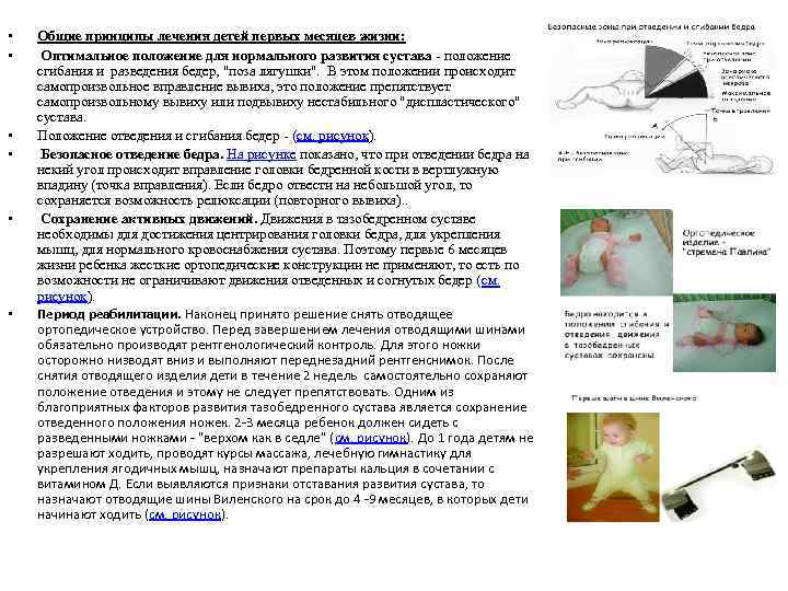  • • • Общие принципы лечения детей первых месяцев жизни: Оптимальное положение для