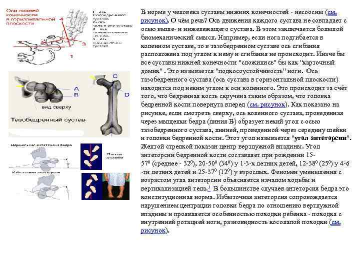  • В норме у человека суставы нижних конечностей - несоосны (см. рисунок). О
