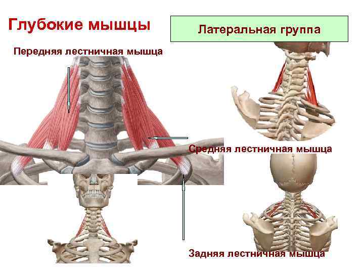 Глубокие мышцы Латеральная группа Передняя лестничная мышца Средняя лестничная мышца Задняя лестничная мышца 