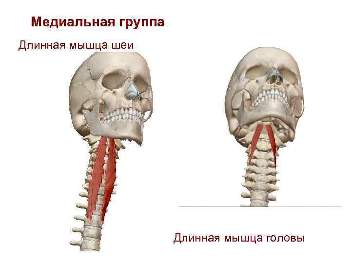 Медиальная группа Длинная мышца шеи Длинная мышца головы 