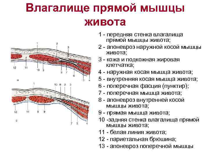 Влагалище прямой мышцы живота 1 - передняя стенка влагалища прямой мышцы живота; 2 -