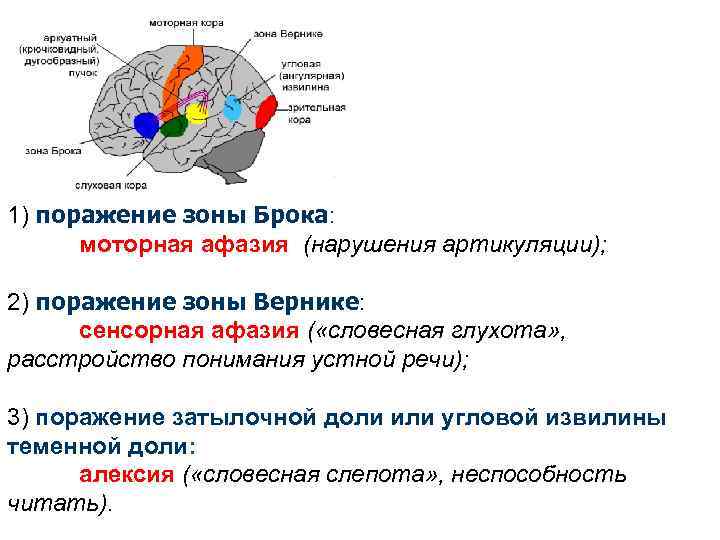 1) поражение зоны Брока: моторная афазия (нарушения артикуляции); 2) поражение зоны Вернике: сенсорная афазия