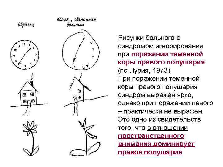 Рисунки больного с синдромом игнорирования при поражении теменной коры правого полушария (по Лурия, 1973)