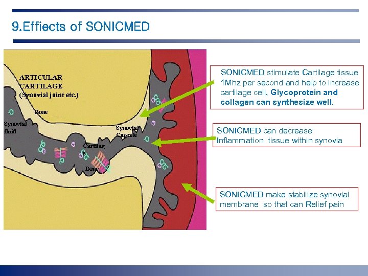 9. Effiects of SONICMED stimulate Cartilage tissue 1 Mhz per second and help to
