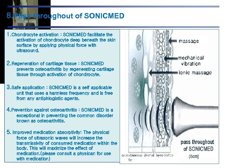 8. Pass throughout of SONICMED 1. Chondrocyte activation : SONICMED facilitate the activation of