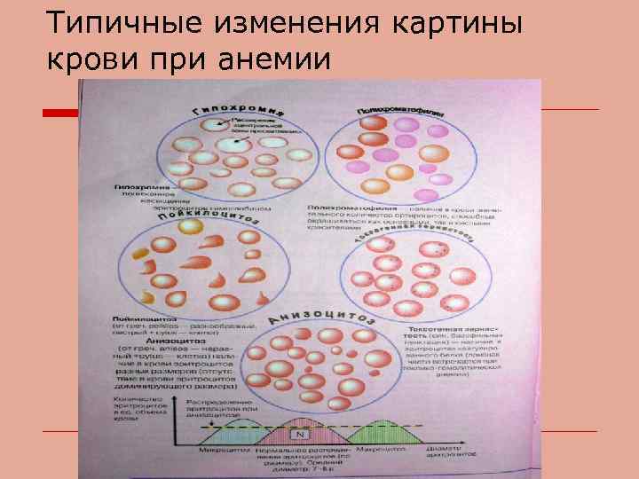 Типичные изменения картины крови при анемии 