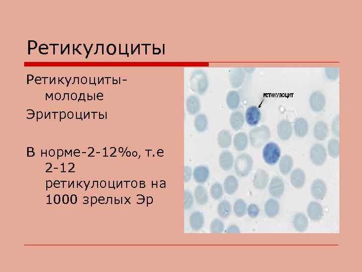 Ретикулоцитымолодые Эритроциты В норме-2 -12%о, т. е 2 -12 ретикулоцитов на 1000 зрелых Эр