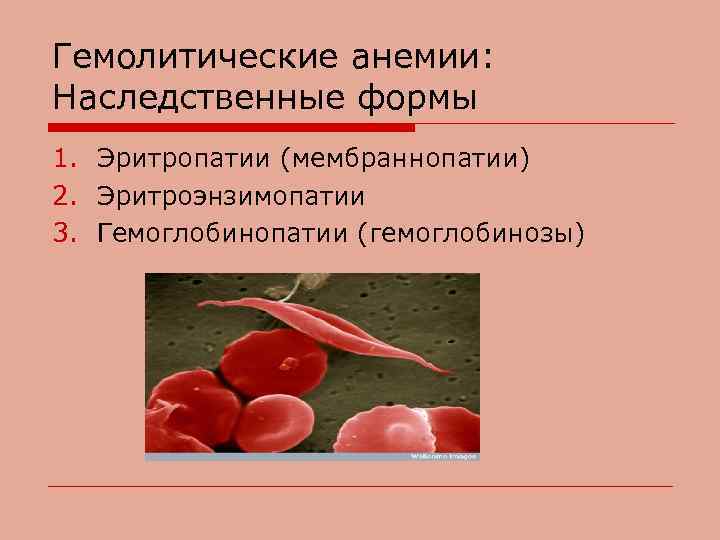 Гемолитические анемии: Наследственные формы 1. Эритропатии (мембраннопатии) 2. Эритроэнзимопатии 3. Гемоглобинопатии (гемоглобинозы) 