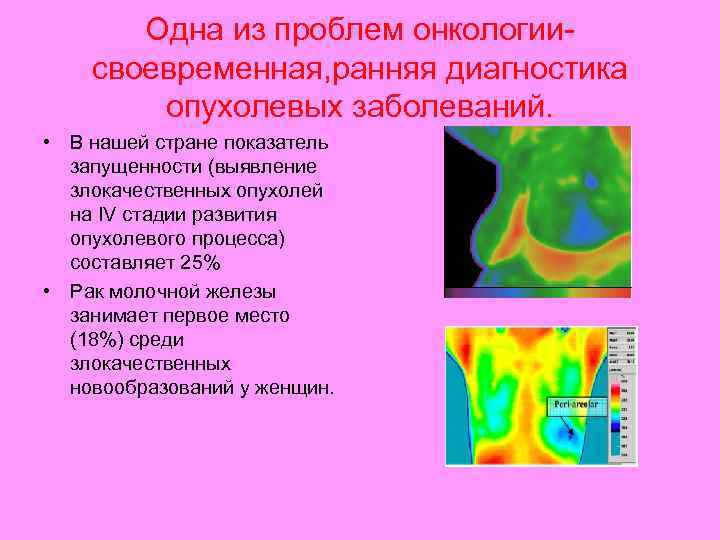Одна из проблем онкологиисвоевременная, ранняя диагностика опухолевых заболеваний. • В нашей стране показатель запущенности