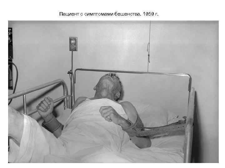 Пациент с симптомами бешенства. 1959 г. 