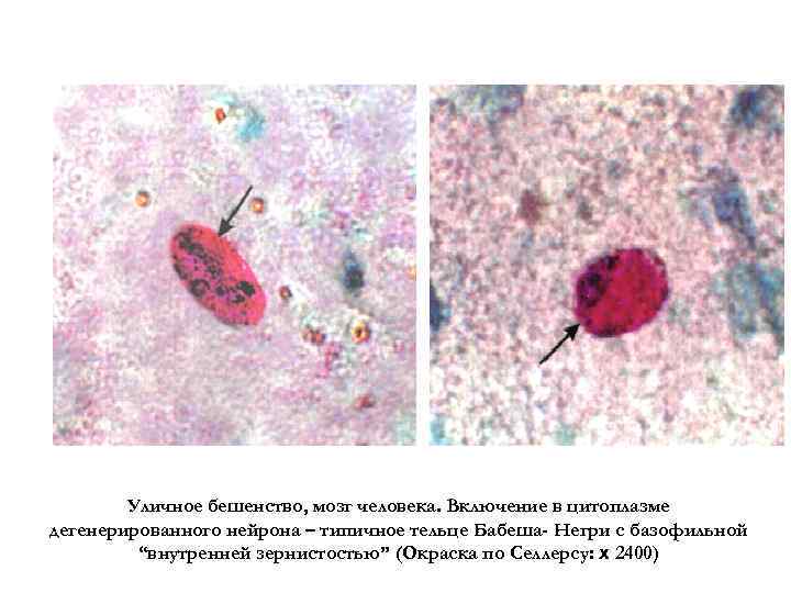 Тельца негри