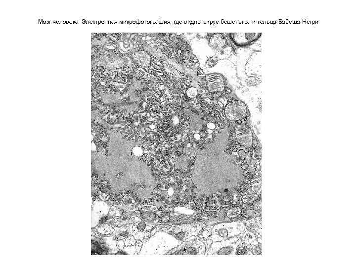 Какова функция органоида электронная микрофотография которого представлена на рисунке