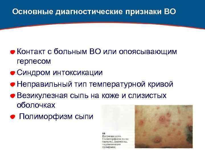 Основные диагностические признаки ВО Контакт с больным ВО или опоясывающим герпесом Синдром интоксикации Неправильный