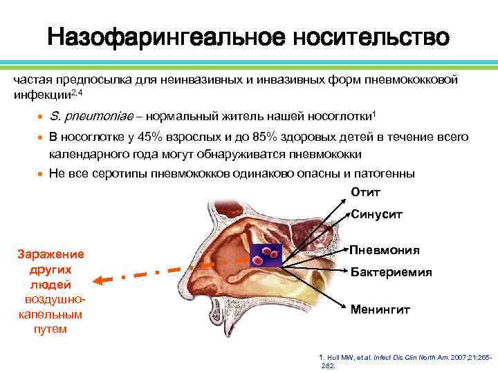 Назофарингеальное носительство частая предпосылка для неинвазивных и инвазивных форм пневмококковой инфекции 2, 4 n