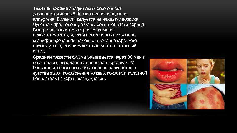 Тяжёлая форма анафилактического шока развивается через 5 -10 мин после попадания аллергена. Больной жалуется