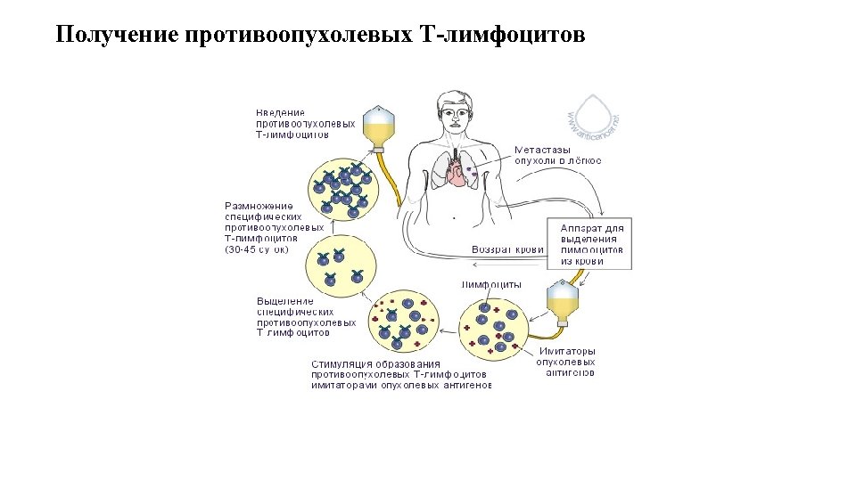 Получение противоопухолевых Т-лимфоцитов 
