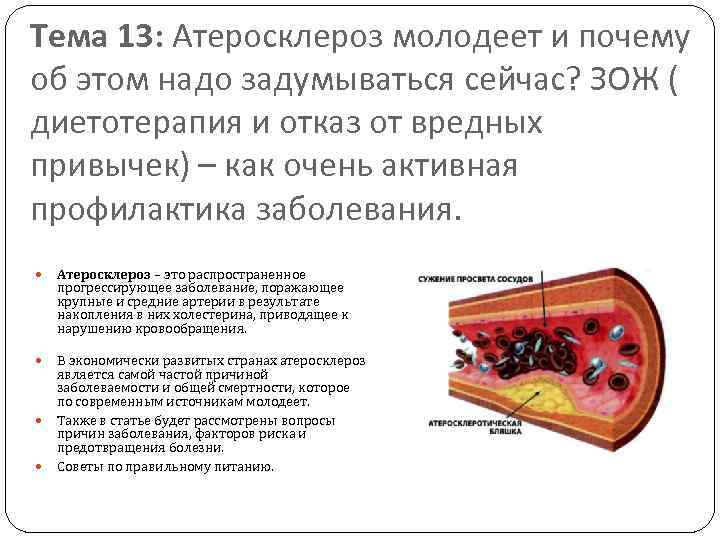 Тема 13: Атеросклероз молодеет и почему об этом надо задумываться сейчас? ЗОЖ ( диетотерапия