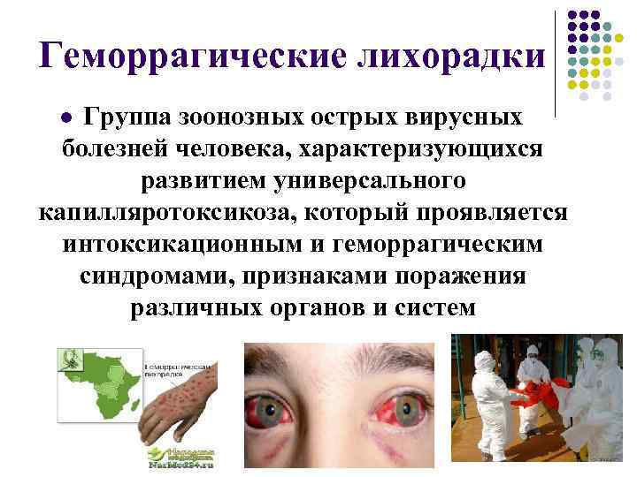 Геморрагические лихорадки Группа зоонозных острых вирусных болезней человека, характеризующихся развитием универсального капилляротоксикоза, который проявляется