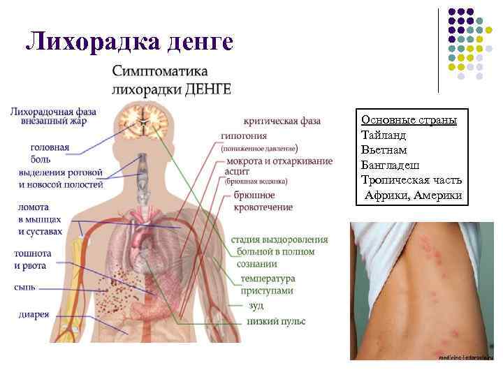 Лихорадка денге Основные страны Тайланд Вьетнам Бангладеш Тропическая часть Африки, Америки 