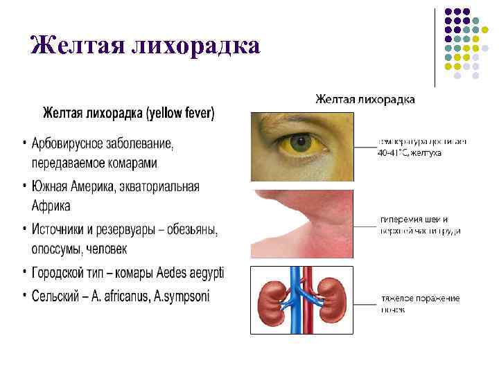 Желтая лихорадка 