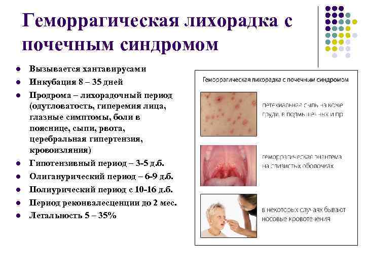 Геморрагическая лихорадка с почечным синдромом l l l l Вызывается хантавирусами Инкубация 8 –