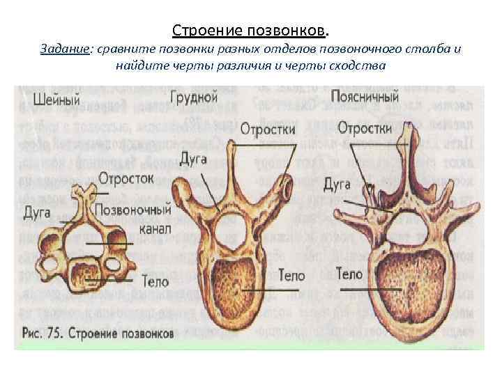 Строение позвонков. Задание: сравните позвонки разных отделов позвоночного столба и найдите черты различия и