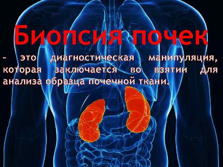 Биопсия почек – это диагностическая манипуляция, которая заключается во взятии для анализа образца почечной