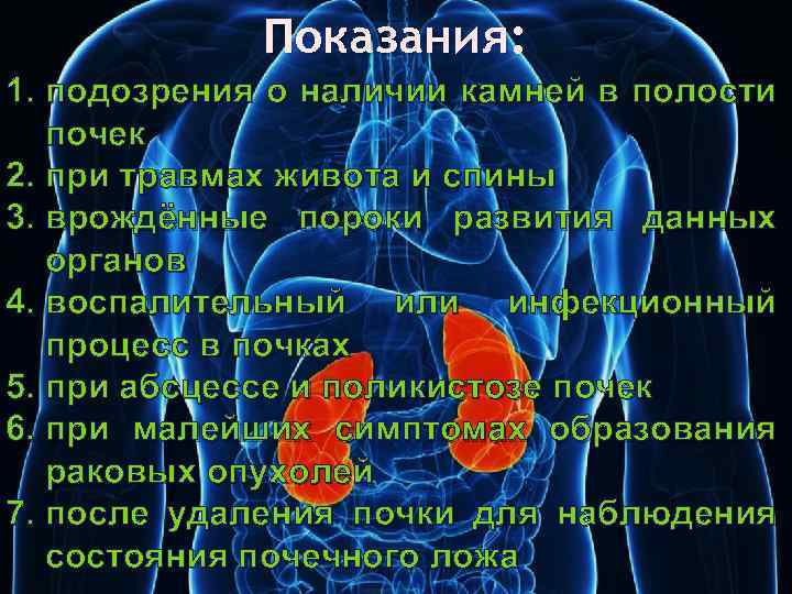 Показания: 1. подозрения о наличии камней в полости почек 2. при травмах живота и