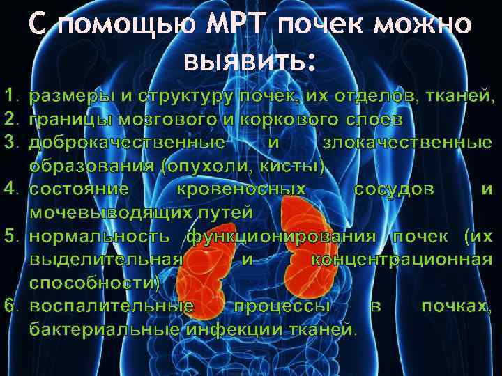 С помощью МРТ почек можно выявить: 1. размеры и структуру почек, их отделов, тканей,