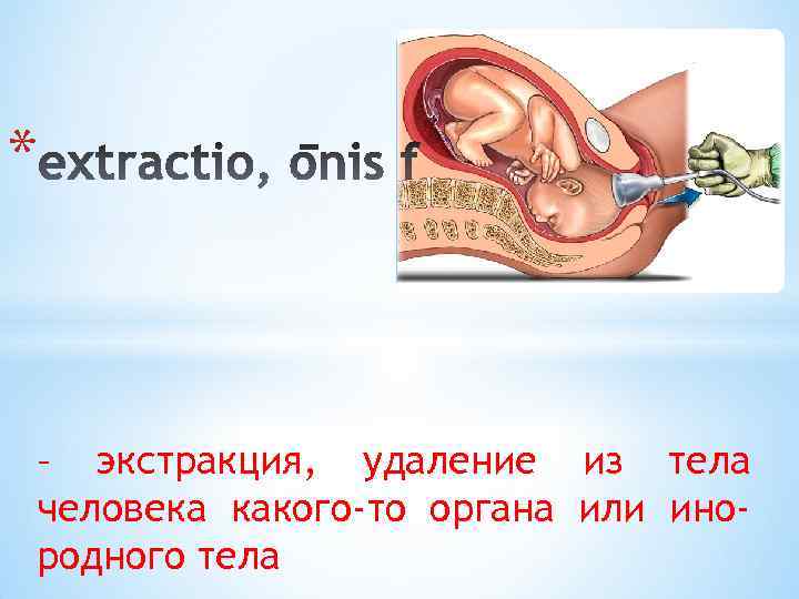 * – экстракция, удаление из тела человека какого-то органа или инородного тела 