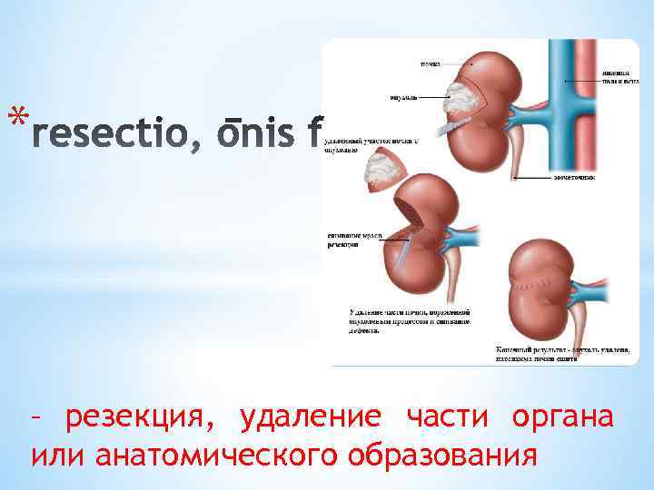 * – резекция, удаление части органа или анатомического образования 