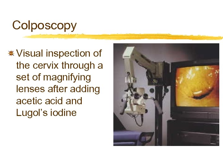 Colposcopy Visual inspection of the cervix through a set of magnifying lenses after adding