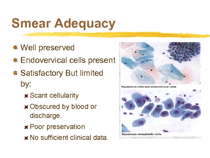 Smear Adequacy Well preserved Endovervical cells present Satisfactory But limited by: Scant cellularity Obscured