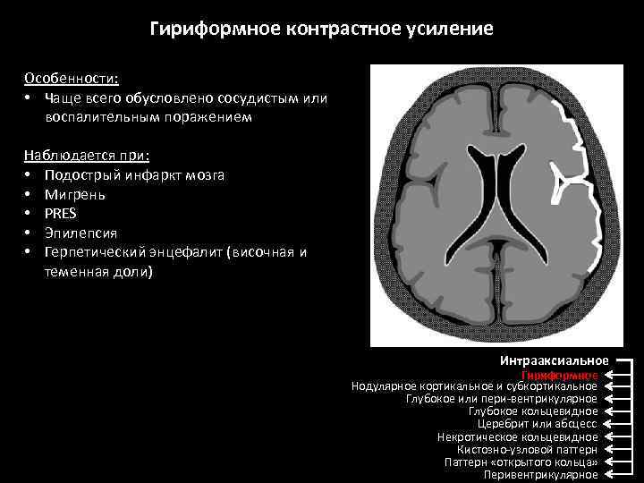 Контрастное усиление при компьютерной томографии мозга применяют в случаях если необходимо