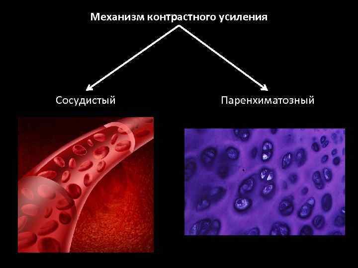 Механизм контрастного усиления Сосудистый Паренхиматозный 