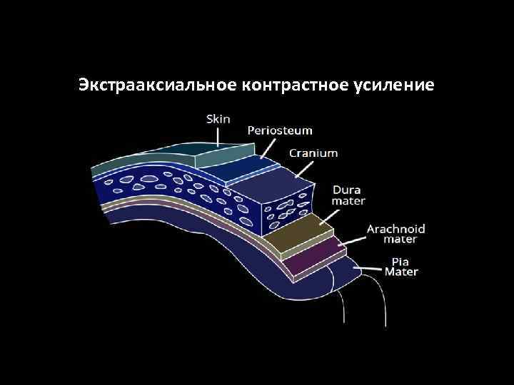 Экстрааксиальное контрастное усиление 