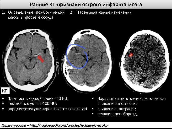 Кт головного мозга презентация