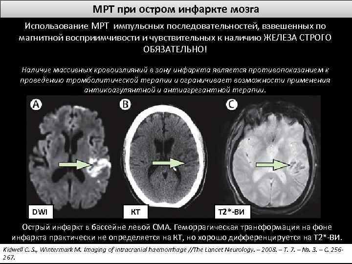 Т1 и т2 взвешенные изображения в мрт