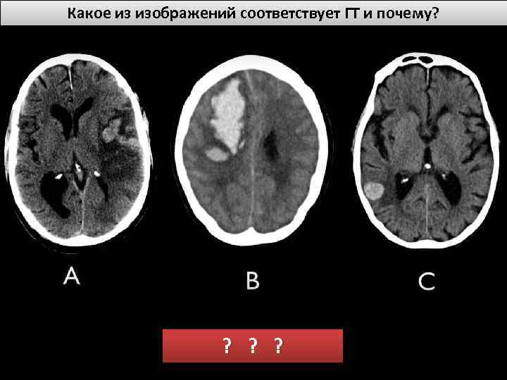 Какое из изображений соответствует ГТ и почему? ? 