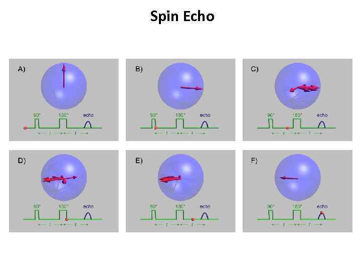 Spin Echo 