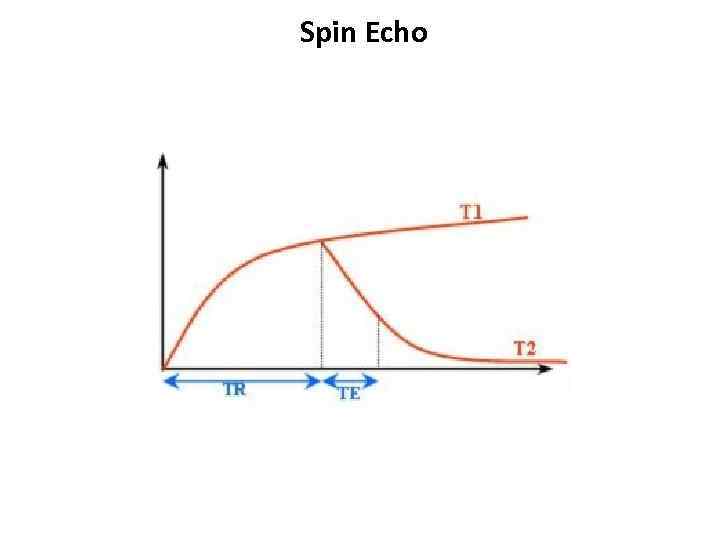 Spin Echo 