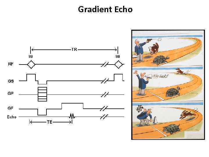 Gradient Echo 