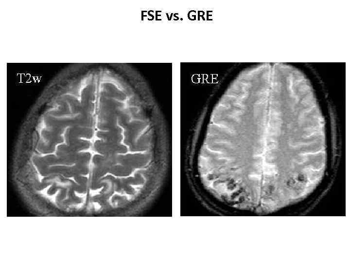 FSE vs. GRE 