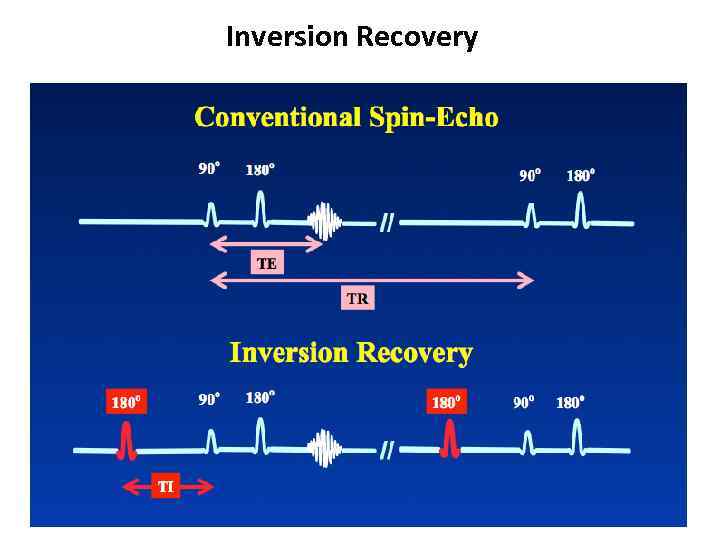 Inversion Recovery 