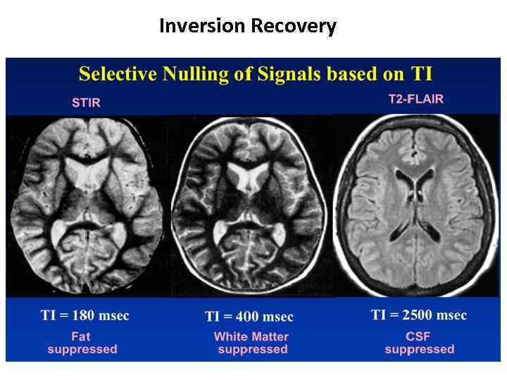 Inversion Recovery 