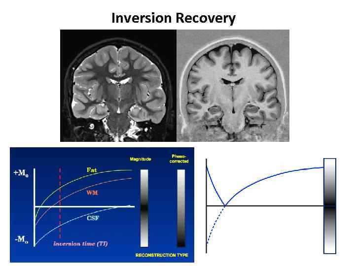 Inversion Recovery 