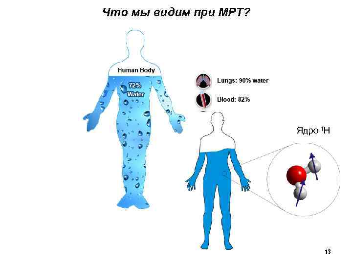 Что мы видим при МРТ? Ядро 1 Н 13 