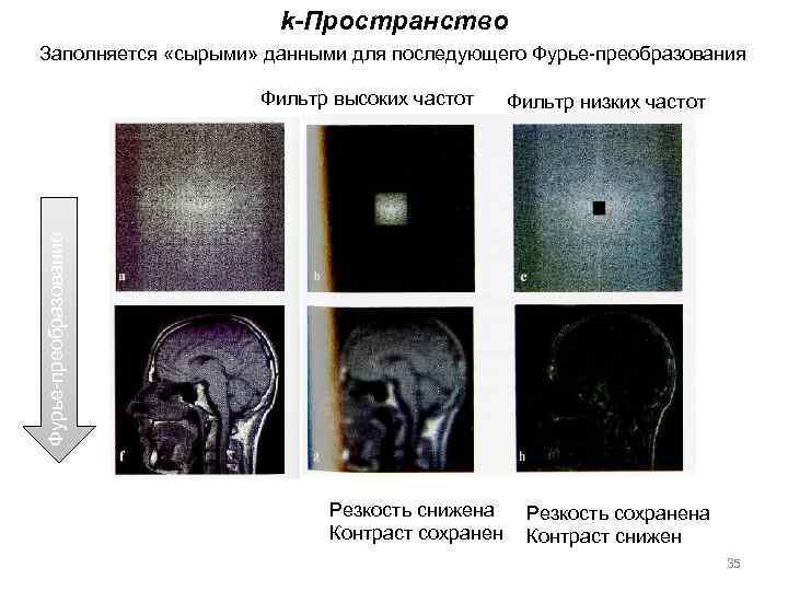 k-Пространство Заполняется «сырыми» данными для последующего Фурье-преобразования Фильтр низких частот Фурье-преобразование Фильтр высоких частот