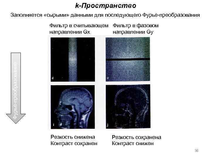 k-Пространство Заполняется «сырыми» данными для последующего Фурье-преобразования Фурье-преобразование Фильтр в считывающем Фильтр в фазовом