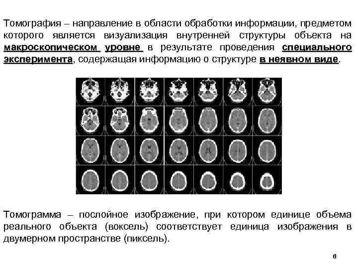 Томография – направление в области обработки информации, предметом которого является визуализация внутренней структуры объекта